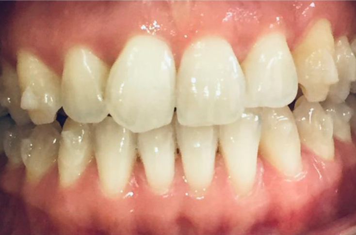 Before - 23 Dental