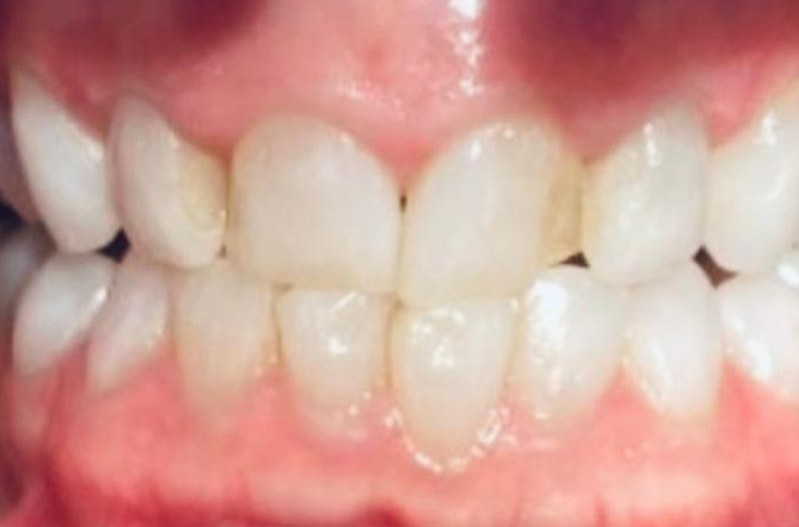 Before - 23 Dental