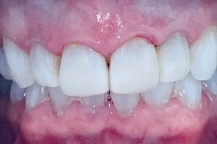 After -23 Dental