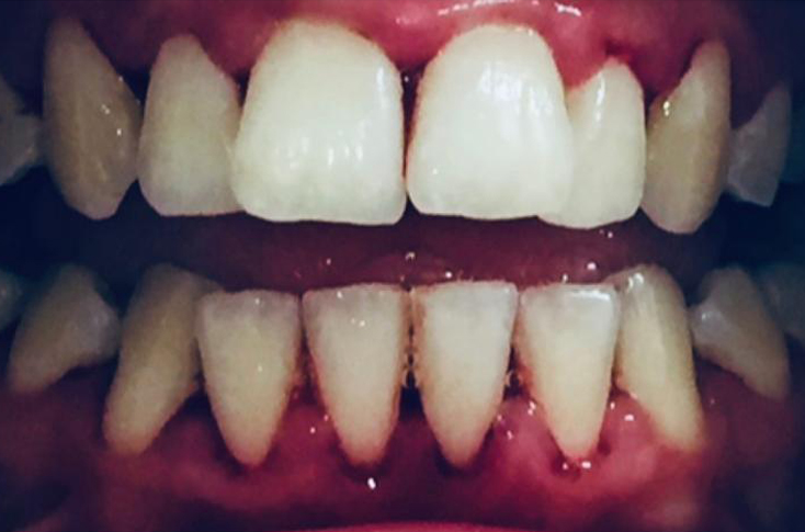Before - 23 Dental