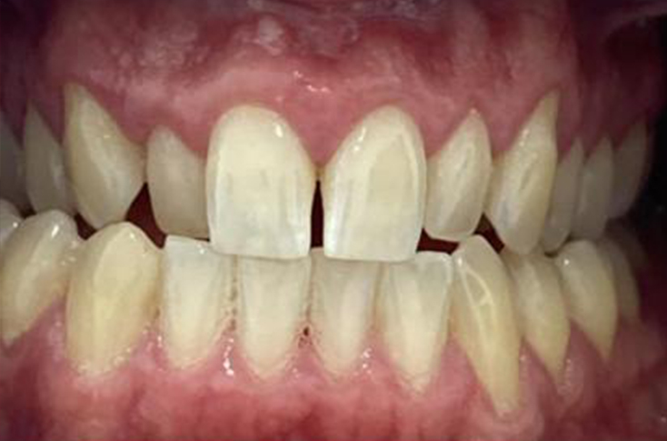 Before - 23 Dental