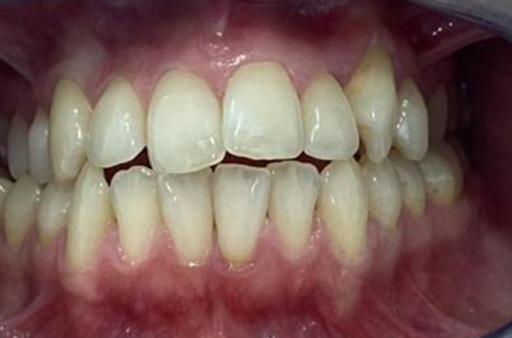Before - 23 Dental